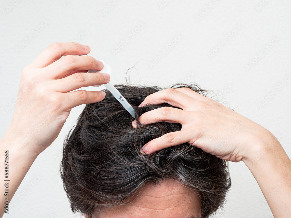 Fototapeta premium 頭皮に育毛剤を塗る男性 スカルプケア