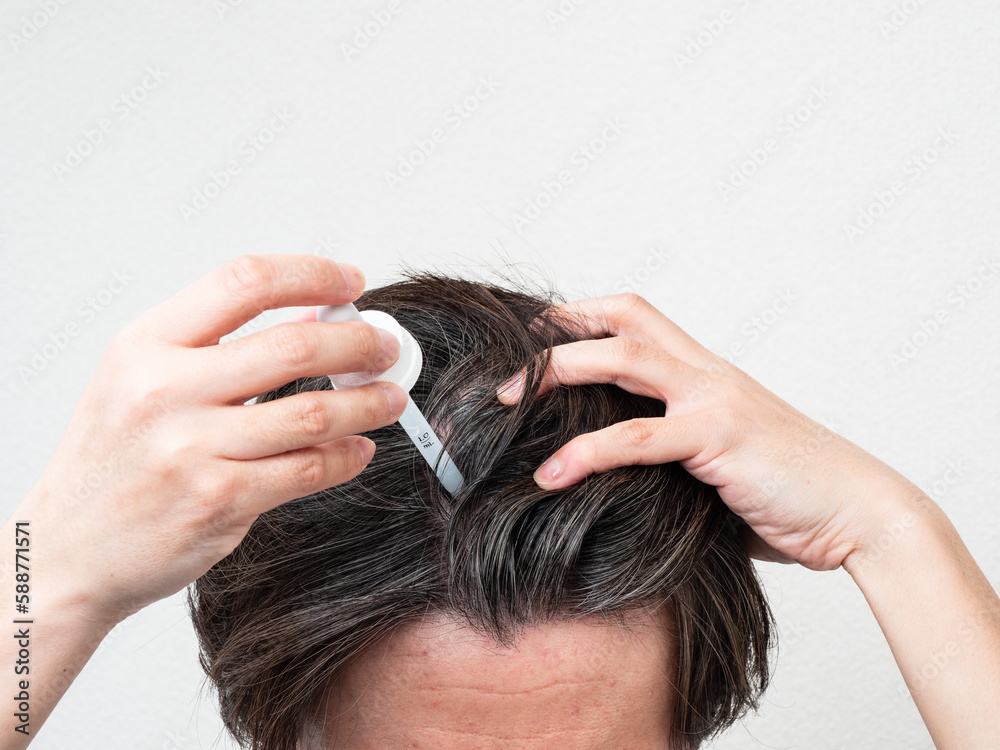 Fototapeta premium 頭皮に育毛剤を塗る男性 スカルプケア