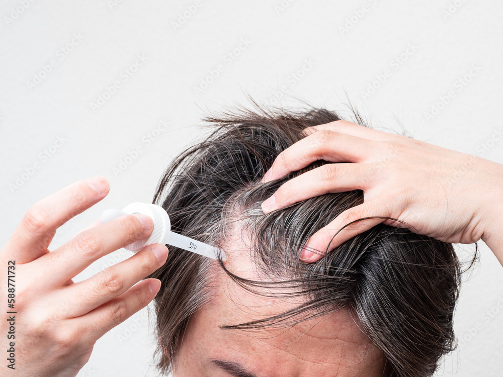 Fototapeta premium 頭皮に育毛剤を塗る男性 スカルプケア