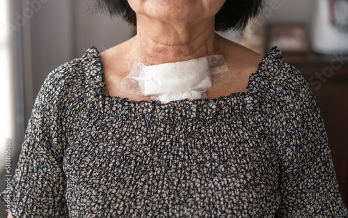 Old woman havr gauze cover neck surgery wound after got surgery.
 photo