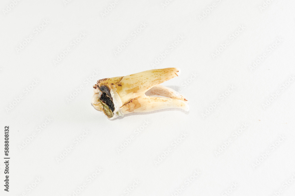 Upper molar tooth completely destroyed decayed crown and curved roots in the apex posed on a white background. Upper molar tooth completely destroyed decayed crown and curved roots in the apex posed on a white background.