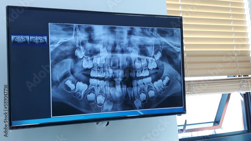 Dental panoramic x-ray in viewer 