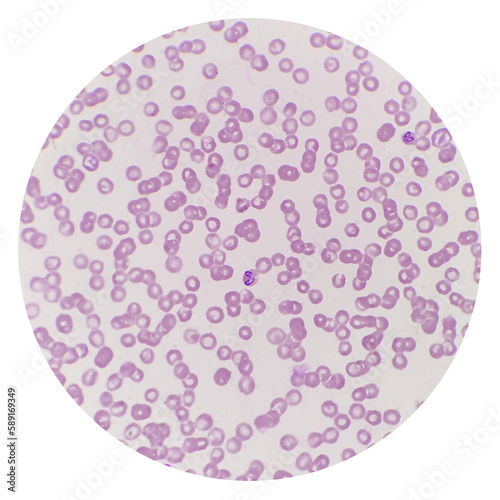 Babesia parasites inside red blood cell, the causative agent of babesiosis. Babesia canis is a parasite that infects red blood cells and can lead to anemia.
