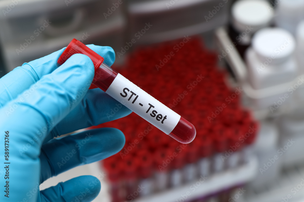 Fototapeta premium STI test to look for abnormalities from blood
