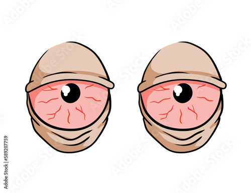 Red hand-drawn eyes. Problem of insomnia. Sleep disorder with capillaries and pupils. Comic drawing. Fatigue and stress. Conjunctivitis infection. Blood eyeballs. Sick illness look