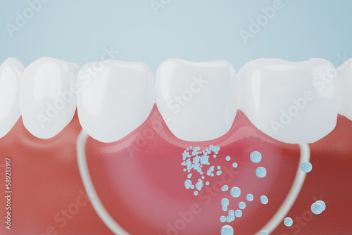 Bubble of toothpaste or fluoride molecule coating gums and teeth to protect oral hygiene. Toothpaste, fresh or bad breath protection concept. 3D rendering.