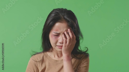 Close Up Of Young Asian Woman Victim Of Violence With Bruise On Face Covering Her Hurt Eye And Crying On Green Screen Background In The Studio
