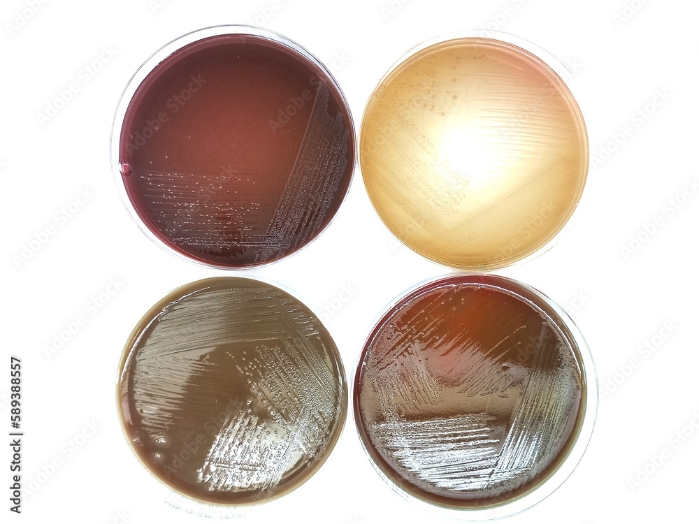 Proteus mirabilis colonies in MacConkey agar plate, Blood agar plate