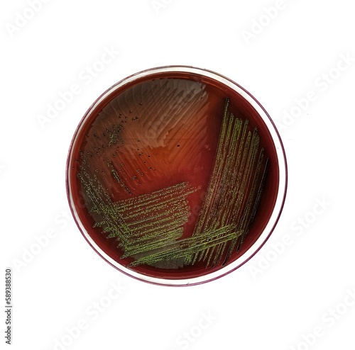 Принти на полотні Escherichia coli colonies, metallic green sheen,  in EMB agar plate