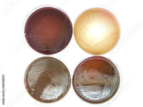 Fotótapéta Proteus mirabilis colonies in MacConkey agar plate, Blood agar plate, Chocolate