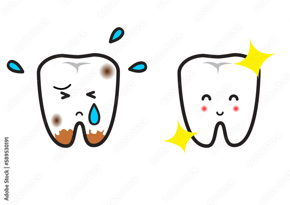 きれいな歯と汚い歯 きれいな歯と汚い歯