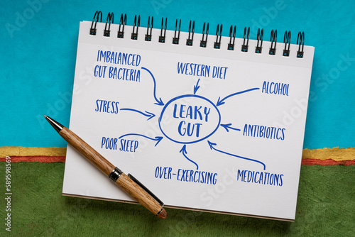 Quadro em tela causes of leaky gut syndrome - text and drawing in a sketchbook, digestive healt