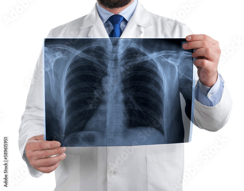 Doctor examining x-ray isolated on white background photo