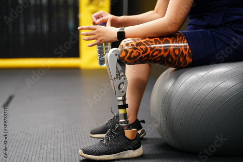 Young female with one prosthetic leg with the practice of using prosthetic legs to walk, exercise and and daily activities