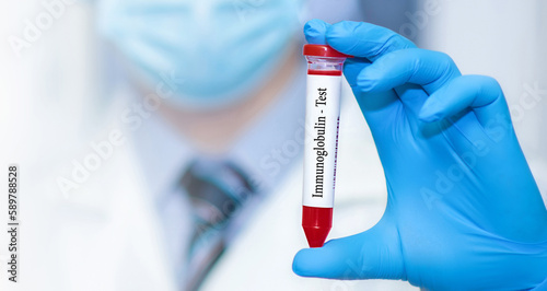 Doctor holding a test blood sample tube with Immunoglobulin test.