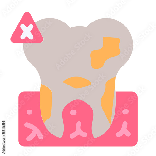 dental gingivitis