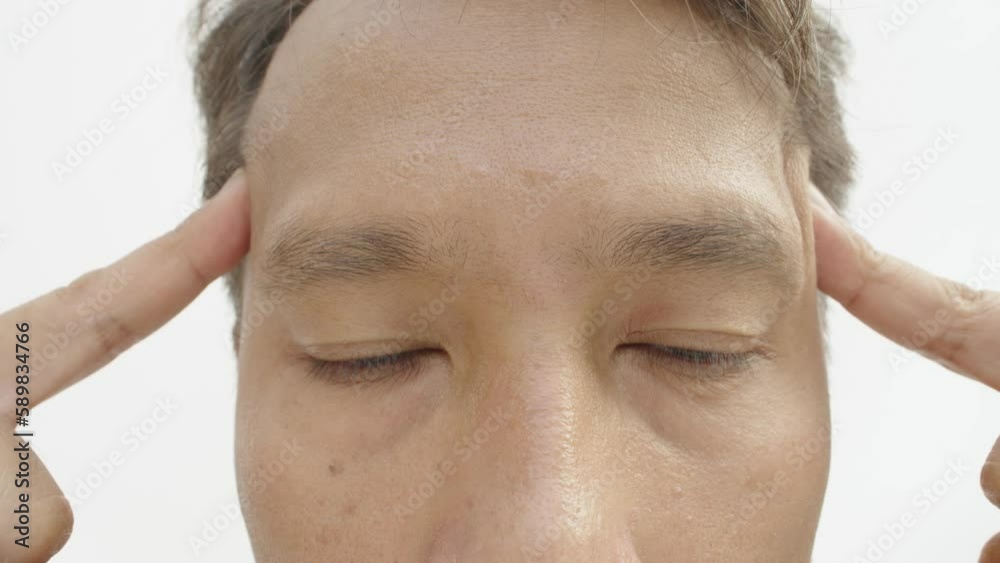 Closeup view of a stressed Asian adult man suffering from bad headache and tension is massaging his head. Closeup view of a stressed Asian adult man suffering from bad headache and tension is massaging his head.