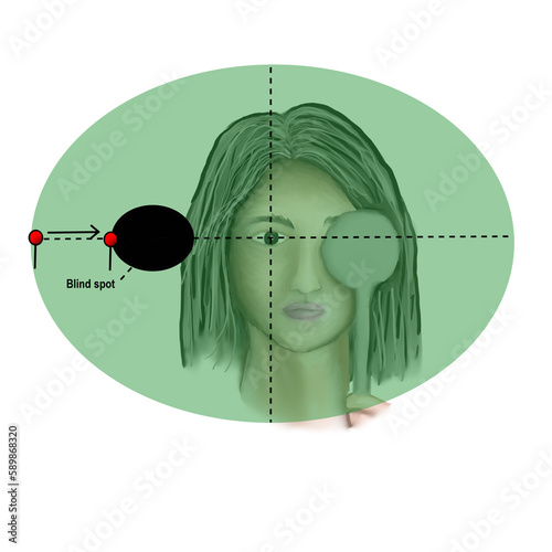The blind spot examination with red dot 