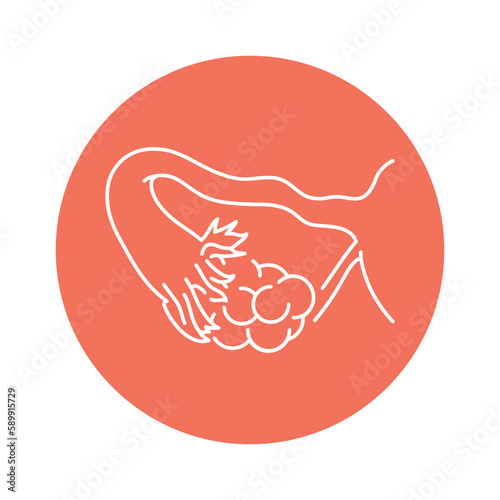 Polycystic color line icon. Gynecology problem