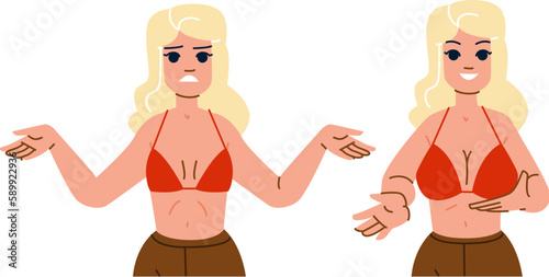 breast surgery vector