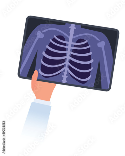 Hand holds x-ray image of humans ribs and lungs. Fluorography and radiography concept. Medical examination and diagnosis flat illustration. Vector design isolated on white background photo