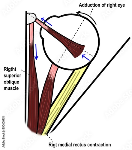 The function of superior oblique muscle of right eye in eye movement.