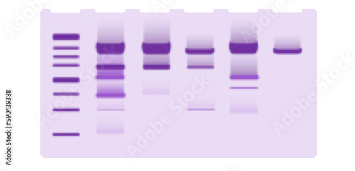 Illustration of protein gel electrophoresis. SDS page illustration