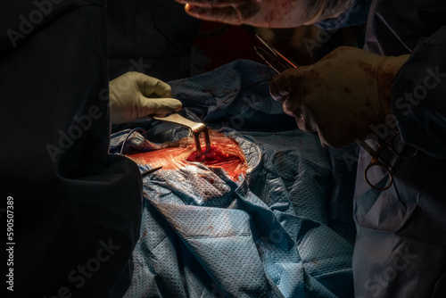 Hip Surgery in Progress: Detailed Footage of Surgeons in the Operating Room