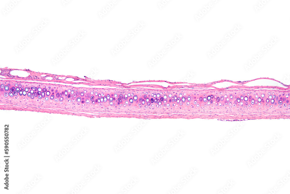 Bone cells, section, 20X light micrograph. Compact bone with osteons or