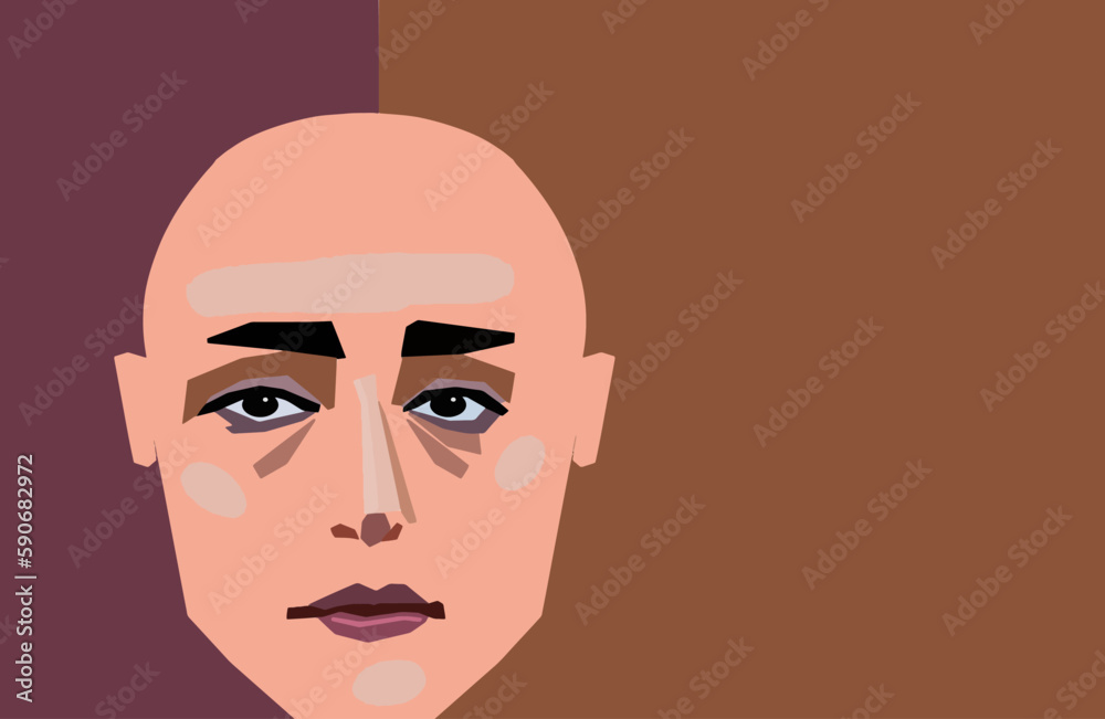 A cancer patient who lost her hair due to chemotherapy is seen in this vector portrait in a graphic style. A cancer patient who lost her hair due to chemotherapy is seen in this vector portrait in a graphic style.