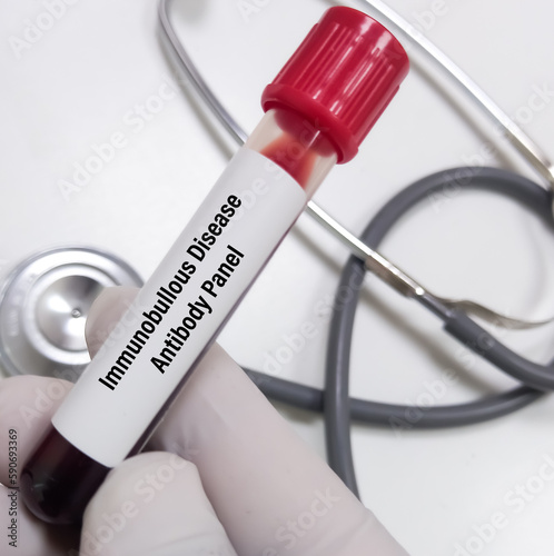Scientist hold blood sample for Immunobullous Disease Antibody Panel test, to diagnosis of skin and mucous membrane disorders. Initial comprehensive testing panel. photo
