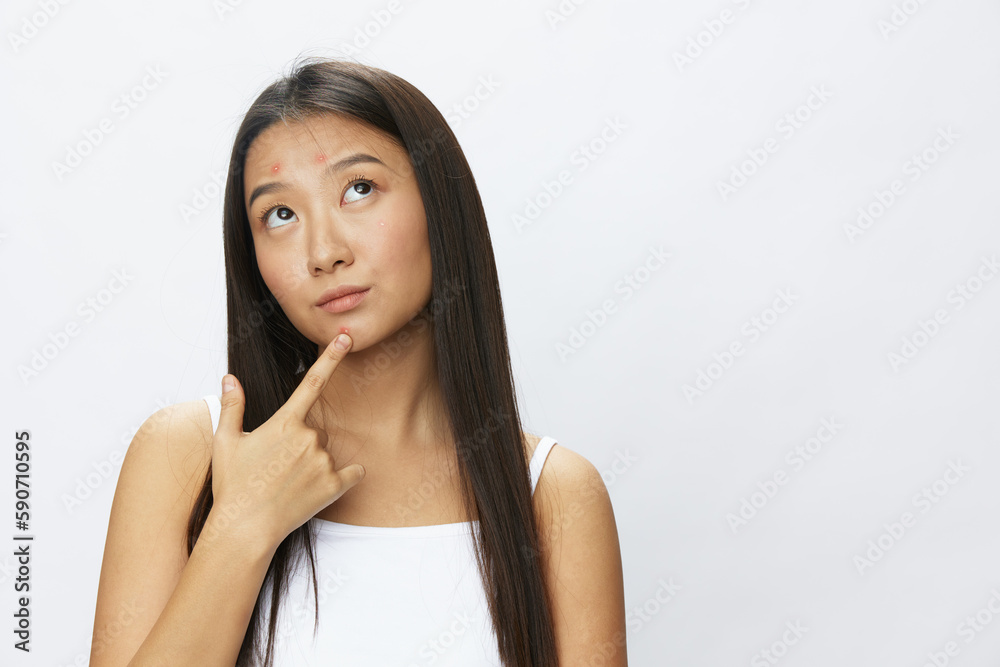 Asian woman facial skin problems, acne and inflammation, red rashes and allergies, chicken pox, sadness from rashes. Facial skin care concept for diseases and nerves Asian woman facial skin problems, acne and inflammation, red rashes and allergies, chicken pox, sadness from rashes. Facial skin care concept for diseases and nerves