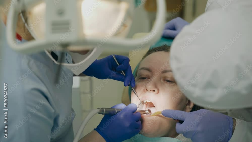 The dentist treats the patient's teeth in the clinic. Close-up of the face, gloved hands, tools for dental treatment. Grinding a tooth filling. The dentist treats the patient's teeth in the clinic. Close-up of the face, gloved hands, tools for dental treatment. Grinding a tooth filling.