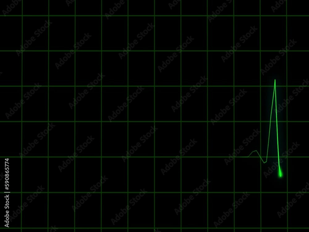 Heart rate electrocardiogram medical monitor with alpha channel Heart rate electrocardiogram medical monitor with alpha channel