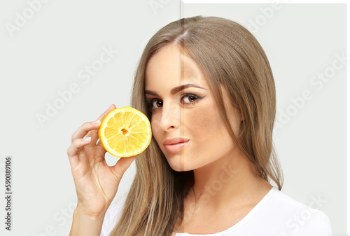 Dark spots, freckles,hyperpigmentation(melasma or chloasma),concept - skin lightening, skin whitening, fruit acids,AHA, Skin Brightening