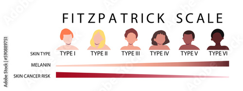 Fitzpatrick scale. Skin types infographic with male and female faceless characters. Human phototypes. Dependence of melanin and skin cancer risk. Vector illustration