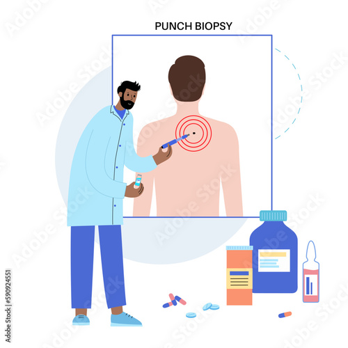 Punch biopsy procedure