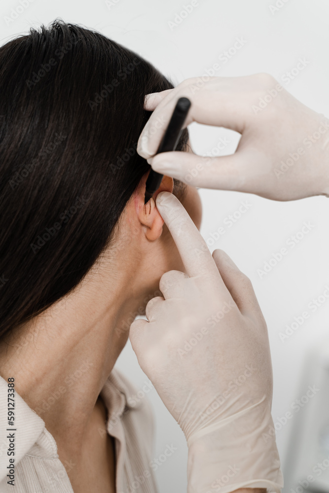 Fototapeta premium Surgeon draw marking on ear before otoplasty cosmetic surgery. Otoplasty markup before ear surgery. Otoplasty mark-up for surgical reshaping of pinna and ear.