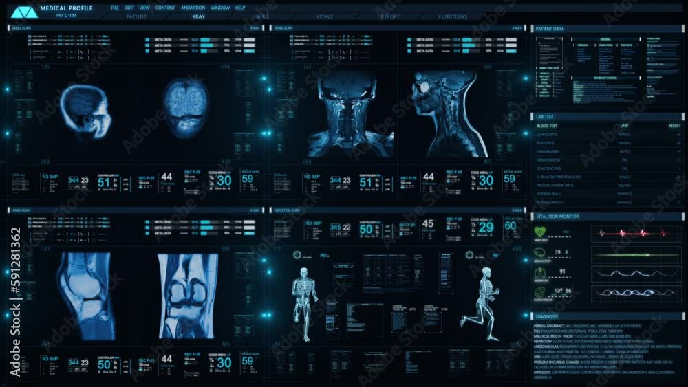 Futuristic Technological Interface Analyzing human anatomy and Morphology. Medical Profile of Patient Showing Knee, Head and Neck MRI Scan, 3D Model Animation Running and Vital Signs. Healthcare.