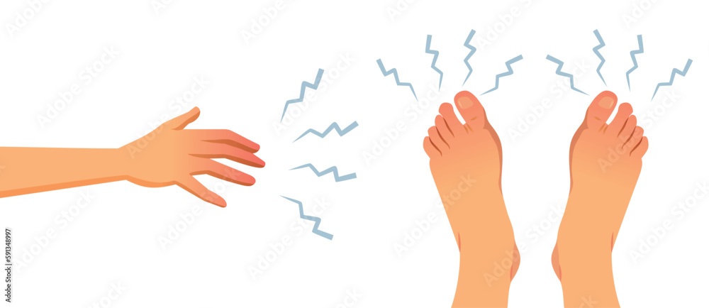 Numbness in Extremities for Feet and Hands Medical Concept Illustration. Person feeling tingling numbness in her extremities suffering from diabetes
Numbness in Extremities for Feet and Hands Medical Concept Illustration. Person feeling tingling numbness in her extremities suffering from diabetes