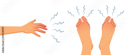 Numbness in Extremities for Feet and Hands Medical Concept Illustration. Person feeling tingling numbness in her extremities suffering from diabetes 
 photo