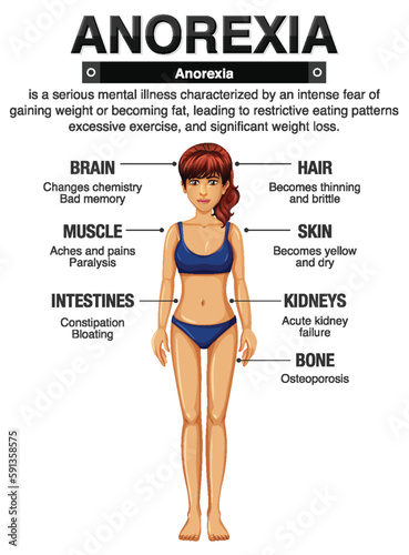 Anorexia (Anorexia) and Its Effects on the Body