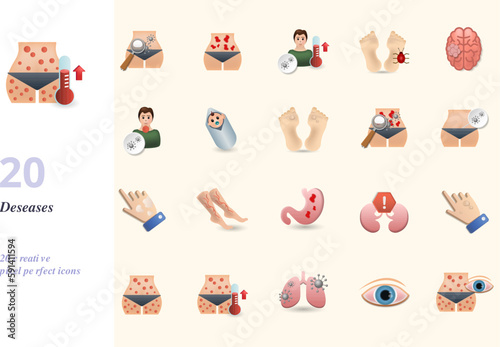 Deseases set. Creative icons: typhoid fever, urticaria, viral fever, tungiasis, tumor, tularemia, warkany syndrome, warts, yersiniosis, yeast infection, vitiligo, varicose, ulcers, uremia, warts
