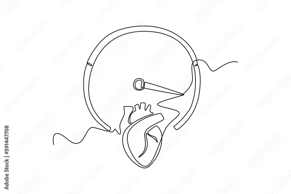 Single one line drawing increased heart rate. World hypertension day concept. Continuous line draw design graphic vector illustration. Single one line drawing increased heart rate. World hypertension day concept. Continuous line draw design graphic vector illustration.