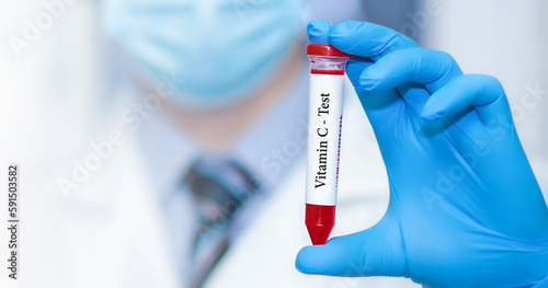 Doctor holding a test blood sample tube with Vitamin ? test.