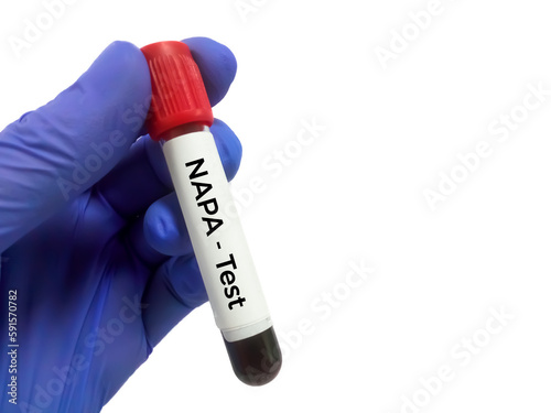 Blood sample for N-Acetylprocainamide or NAPA test, to set therapeutic range for patient. photo