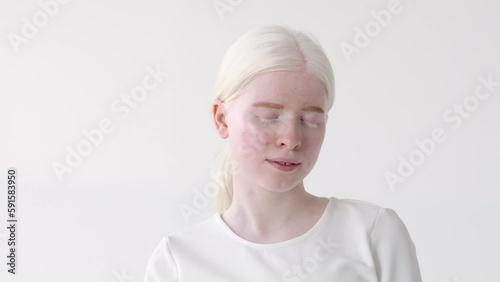 Pretty albino teen girl, cute beautiful model wearing white t-shirt standing on white studio background. Inclusive unusual natural beauty, inclusion, albinism and diversity concept.
