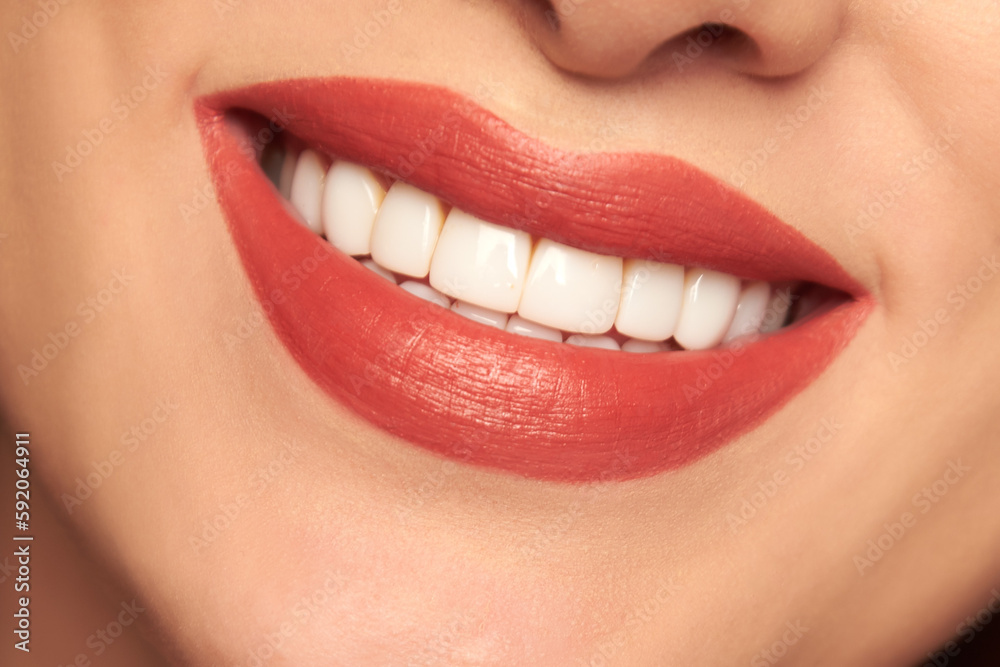 lips 4 lips 4
