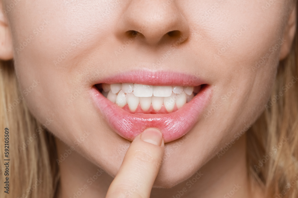 Young woman showing healthy gums, closeup view Young woman showing healthy gums, closeup view