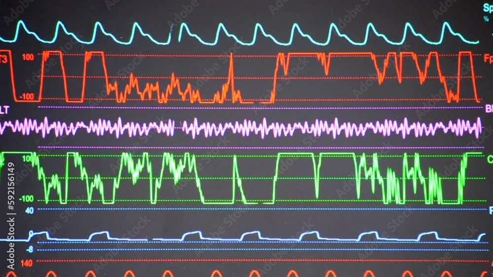 Modern patient monitor. Electronic Health Monitor displaying medical
